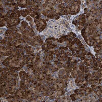 Immunohistochemistry-Paraffin: MALSU1 Antibody [NBP1-86026]