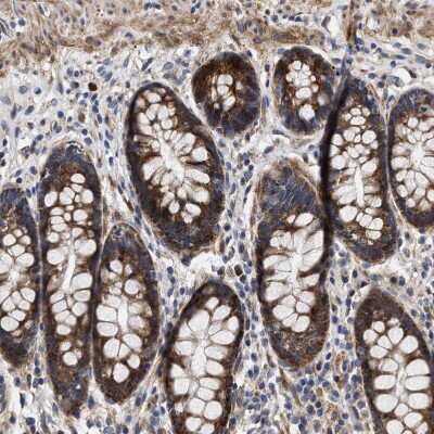 Immunohistochemistry-Paraffin: MALSU1 Antibody [NBP1-86026]
