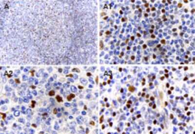 Immunohistochemistry-Paraffin: MALT1 Antibody [NB100-56158]