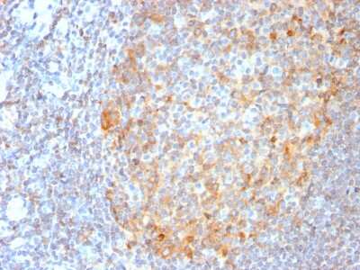 Immunohistochemistry-Paraffin: MALT1 Antibody (MT1/3159R) - Azide and BSA Free [NBP3-08825]