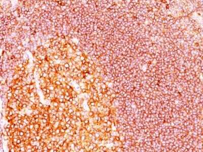 Immunohistochemistry-Paraffin: MALT1 Antibody (MT1/410) - Azide and BSA Free [NBP2-33054]