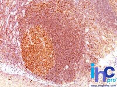 Immunohistochemistry-Paraffin: MALT1 Antibody (MT1/410) - IHC-Prediluted [NBP2-44348]