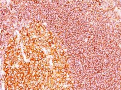 Immunohistochemistry-Paraffin: MALT1 Antibody (MT1/410) - IHC-Prediluted [NBP2-44348]