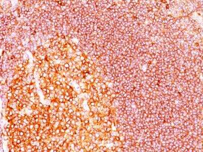 Immunohistochemistry-Paraffin: MALT1 Antibody (MT1/410) [NBP2-29430]