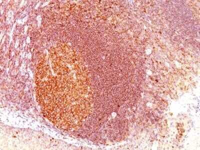 Immunohistochemistry-Paraffin: MALT1 Antibody (SPM578) - Azide and BSA Free [NBP2-34811]