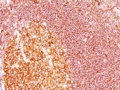 Immunohistochemistry-Paraffin: MALT1 Antibody (SPM578) - Azide and BSA Free [NBP2-34811]