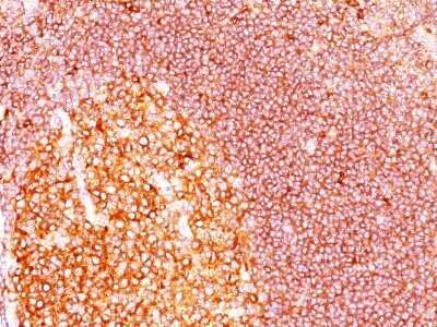 Immunohistochemistry-Paraffin: MALT1 Antibody (SPM578) - IHC-Prediluted [NBP2-44349]