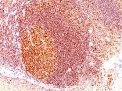Immunohistochemistry-Paraffin: MALT1 Antibody (SPM578) [NBP2-32872]