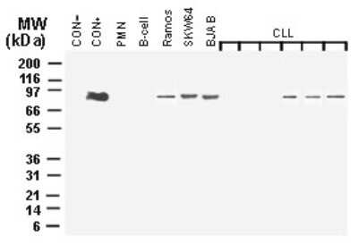 Western Blot: MALT1 Antibody [NB100-56158]