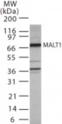 Western Blot: MALT1 Antibody [NBP2-24732]