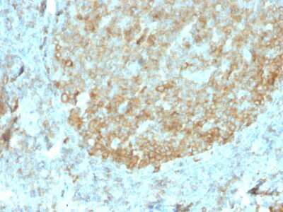 Immunohistochemistry-Paraffin: MALT1 Antibody (rMT1/410) - Azide and BSA Free [NBP3-08824]