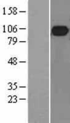 Western Blot: MALT1 Overexpression Lysate [NBL1-12832]