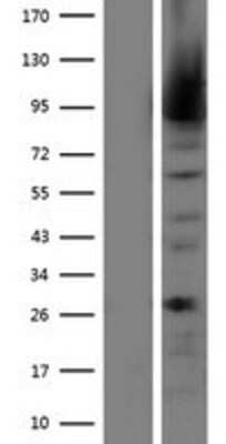 Western Blot: MALT1 Overexpression Lysate [NBP2-05067]