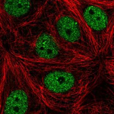 Immunocytochemistry/ Immunofluorescence: MAMDC4 Antibody [NBP2-57130]