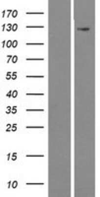 Western Blot: MAMDC4 Overexpression Lysate [NBP2-04521]