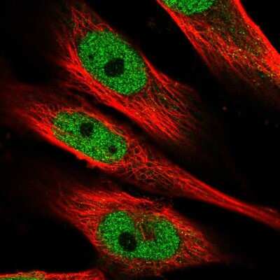 Immunocytochemistry/ Immunofluorescence: MAML1 Antibody [NBP2-57191]