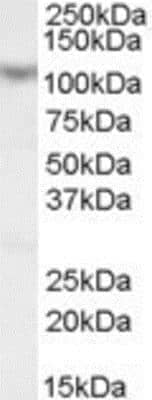 Western Blot: MAML1 Antibody [NB100-1306]