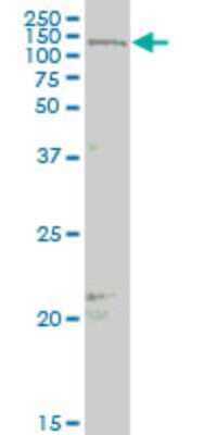 Western Blot: MAML2 Antibody (4A1) [H00084441-M03]