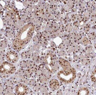 Immunohistochemistry-Paraffin: MAML2 Antibody [NBP1-82891]