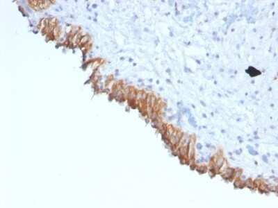 Immunohistochemistry-Paraffin: MAML2 Antibody (MAML2/1302) - Azide and BSA Free [NBP2-54588]