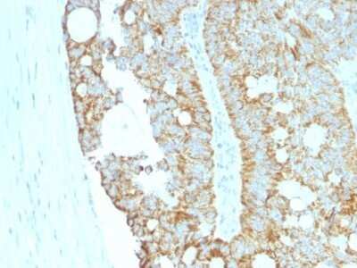 Immunohistochemistry-Paraffin: MAML2 Antibody (MAML2/1302) - Azide and BSA Free [NBP2-54588]