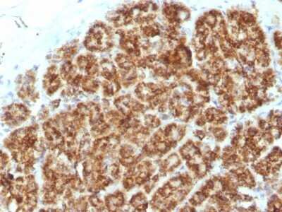 Immunohistochemistry-Paraffin: MAML2 Antibody (MAML2/1302) - Azide and BSA Free [NBP2-54588]