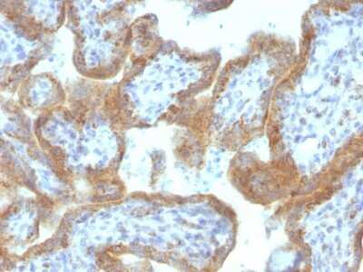 Immunohistochemistry-Paraffin: MAML2 Antibody (MAML2/1302) - Azide and BSA Free [NBP2-54588]