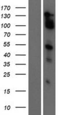 Western Blot: MAML2 Overexpression Lysate [NBP2-06024]
