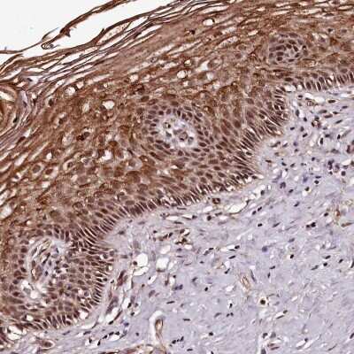 Immunohistochemistry-Paraffin: MAML3 Antibody [NBP1-86674]