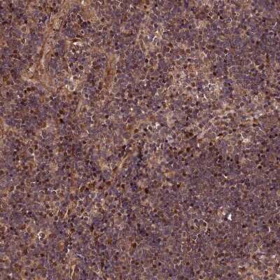 Immunohistochemistry-Paraffin: MAML3 Antibody [NBP1-86674]