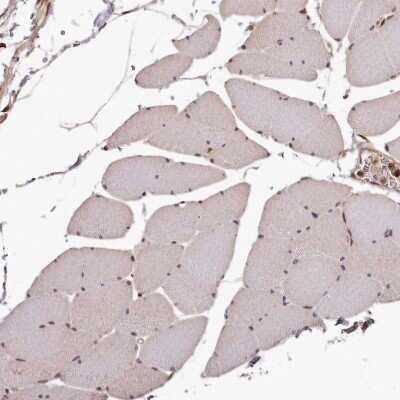 Immunohistochemistry-Paraffin: MAML3 Antibody [NBP1-86674]
