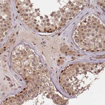 Immunohistochemistry-Paraffin: MAML3 Antibody [NBP1-86674]