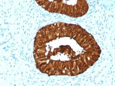 Immunohistochemistry-Paraffin: MAML3 Antibody (MAML3/1303) [NBP2-47646]