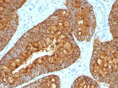 Immunohistochemistry-Paraffin: MAML3 Antibody (MAML3/1303) - Azide and BSA Free [NBP2-54309]