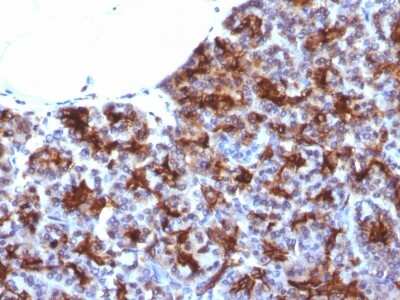 Immunohistochemistry-Paraffin: MAML3 Antibody (MAML3/1303) - Azide and BSA Free [NBP2-54309]