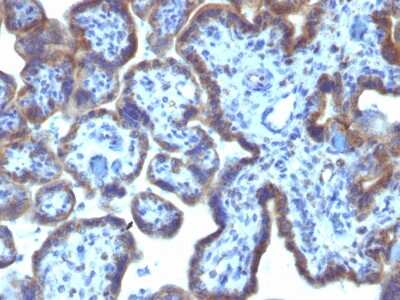 Immunohistochemistry-Paraffin: MAML3 Antibody (MAML3/1303) - Azide and BSA Free [NBP2-54309]