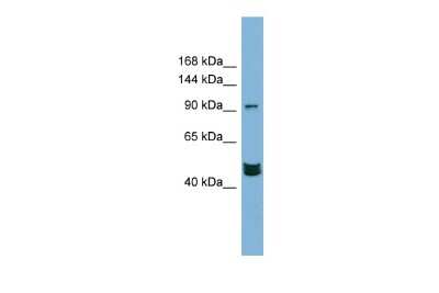 Western Blot: MAML3 Antibody [NBP3-09240]