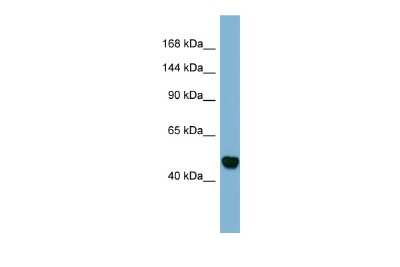 Western Blot: MAML3 Antibody [NBP3-09241]