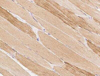 Immunohistochemistry-Paraffin: MAMLD1 Antibody [NBP3-12581]