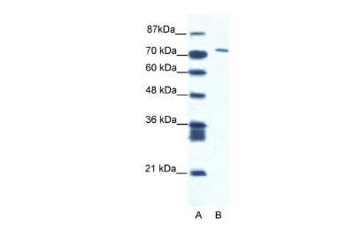 Western Blot: MAMLD1 Antibody [NBP2-83177]