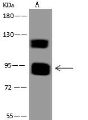 Western Blot: MAMLD1 Antibody [NBP3-12581]