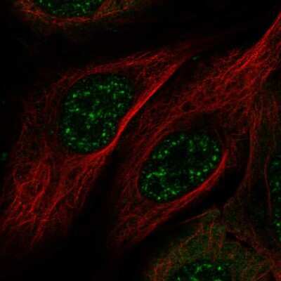 Immunocytochemistry/ Immunofluorescence: MAMSTR Antibody [NBP2-56221]