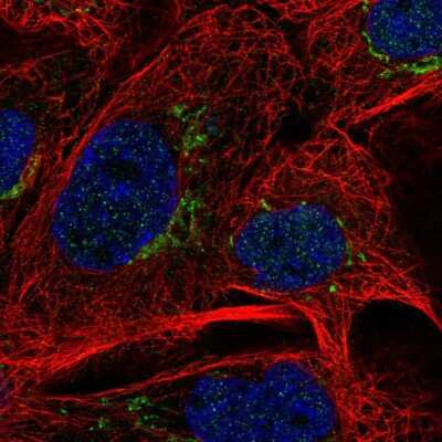 Immunocytochemistry/ Immunofluorescence: MAN1A2 Antibody [NBP2-56757]