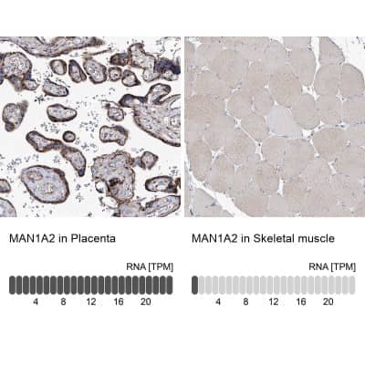 Immunohistochemistry-Paraffin: MAN1A2 Antibody [NBP1-82802]