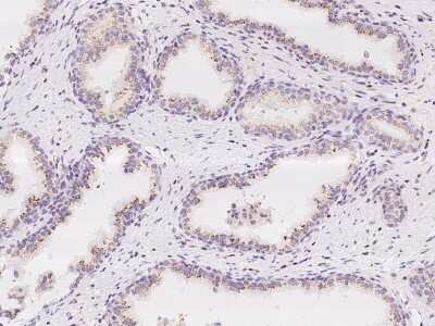 Immunohistochemistry-Paraffin: MAN1A2 Antibody [NBP2-97194]