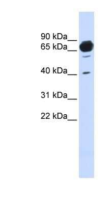 Western Blot: MAN1A2 Antibody [NBP1-60058]