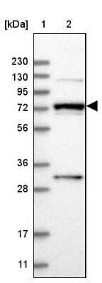 Western Blot: MAN1A2 Antibody [NBP1-82802]