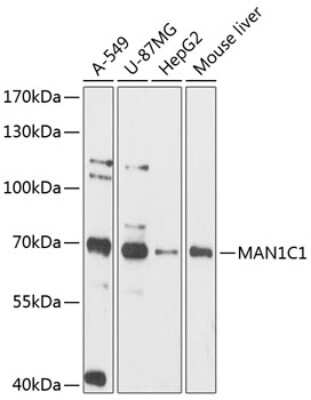 Western Blot: MAN1C1 AntibodyAzide and BSA Free [NBP3-05040]