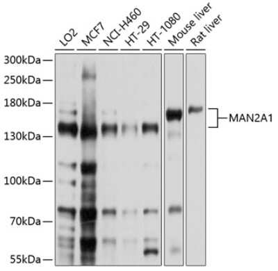 Western Blot: MAN2A1 AntibodyBSA Free [NBP2-92006]