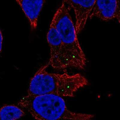 Immunocytochemistry/ Immunofluorescence: MAN2A2 Antibody [NBP2-69054]